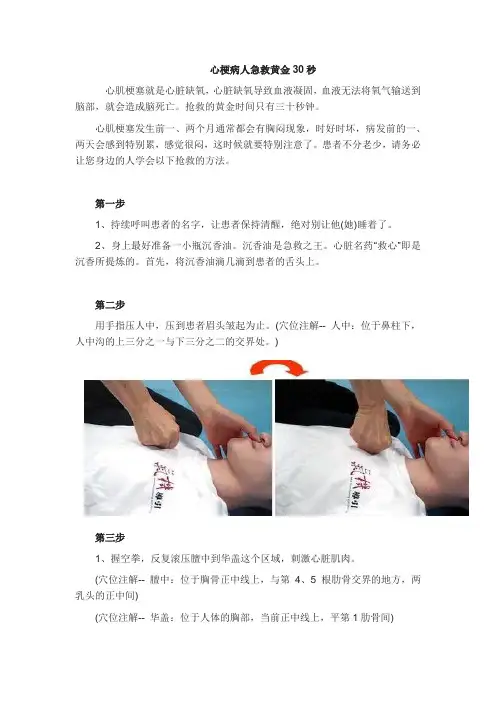 心梗病人急救黄金30秒