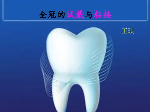 全冠的试戴与粘接