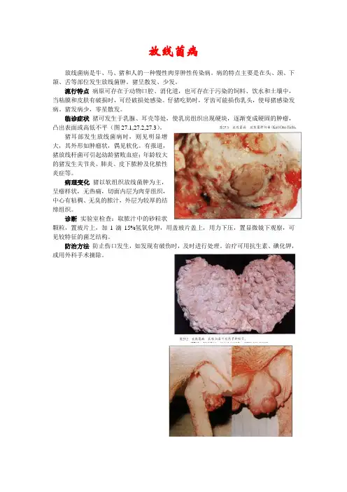 放线菌病