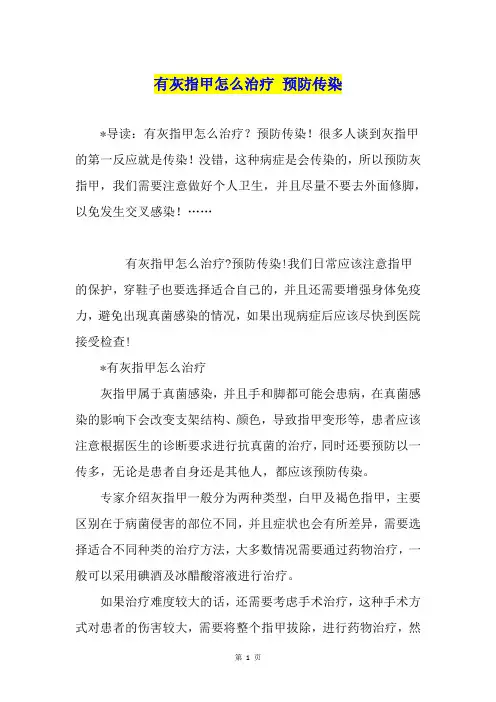 有灰指甲怎么治疗 预防传染