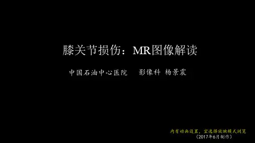 膝关节损伤：MR图像解读