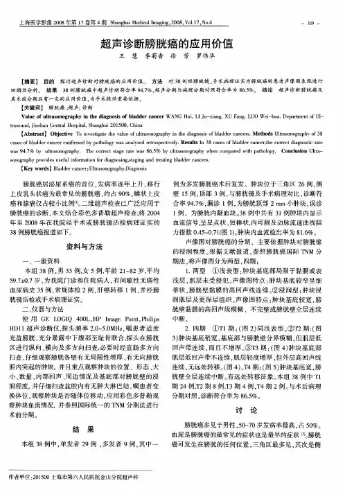 超声诊断膀胱癌的应用价值