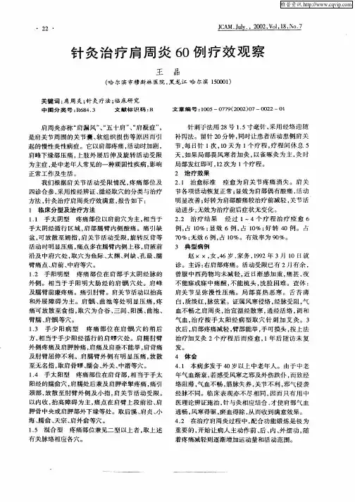 针灸治疗肩周炎60例疗效观察