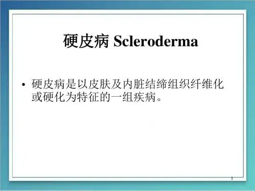 (医学课件)硬皮病PPT幻灯片