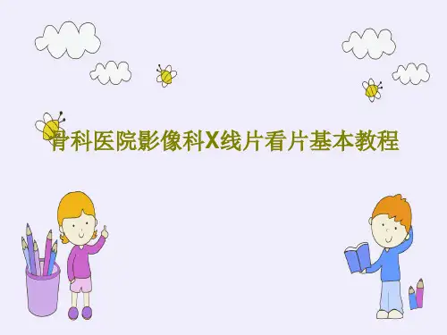 骨科医院影像科X线片看片基本教程PPT文档共91页