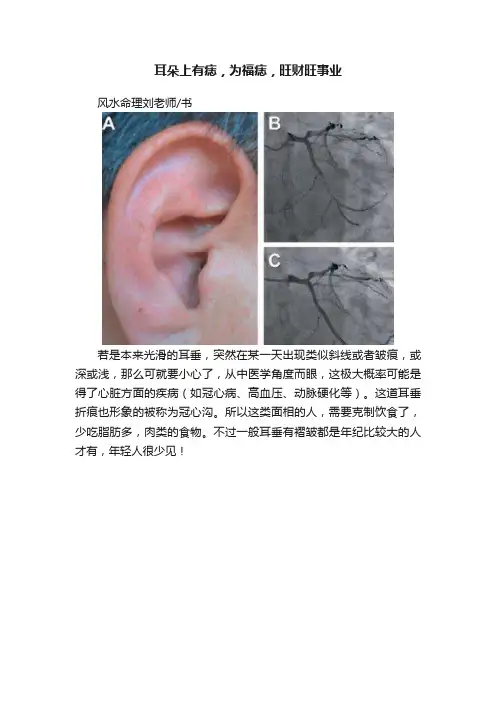 耳朵上有痣，为福痣，旺财旺事业