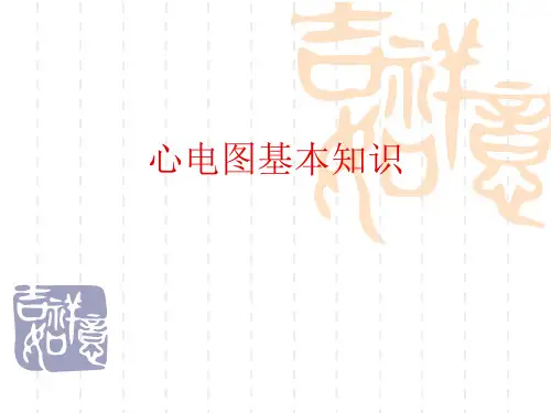 心电图基本知识