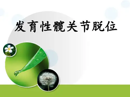 发育性髋关节脱位