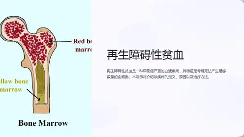 再生障碍性贫血