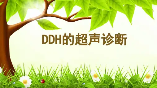 DDH的超声诊断ppt演示课件