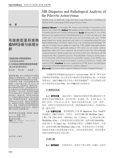 毛细胞型星形细胞瘤MR诊断与病理分析