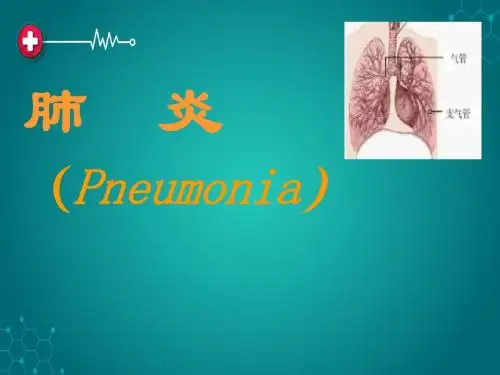 肺炎教学课件ppt课件