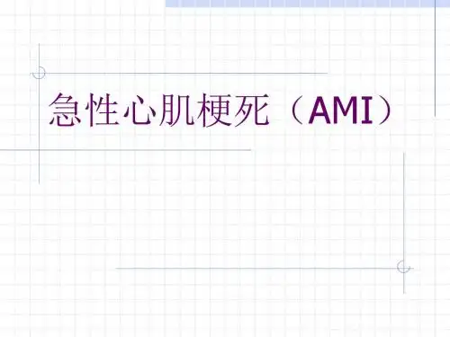 心肌梗塞PPT课件