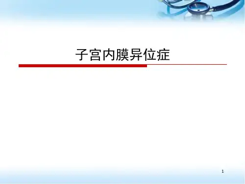 子宫内膜异位症(课堂PPT)