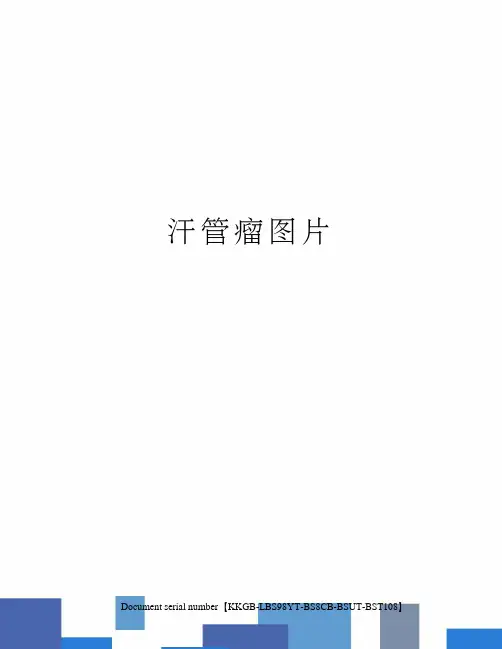 汗管瘤图片