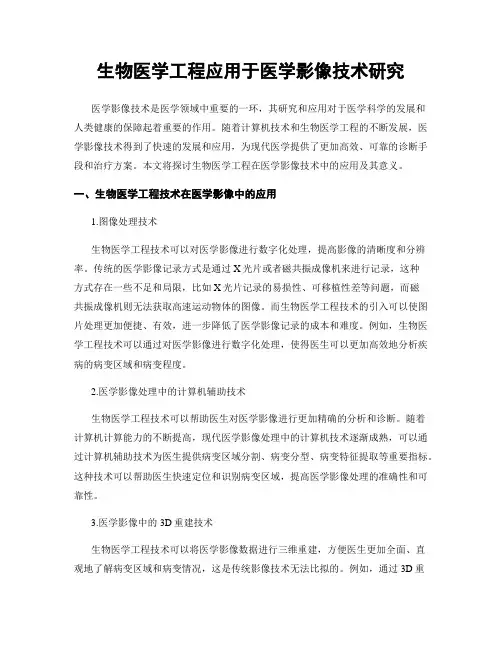 生物医学工程应用于医学影像技术研究