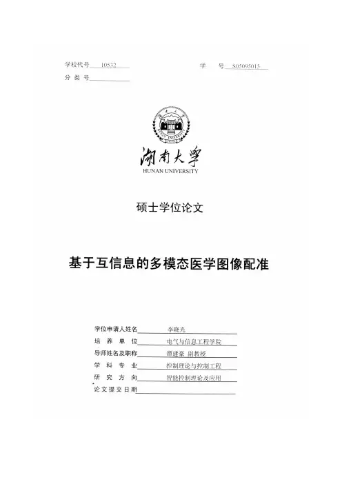 基于互信息的多模态医学图像配准