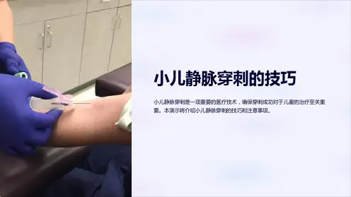 小儿静脉穿刺的技巧