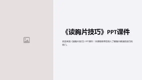 《读胸片技巧》课件