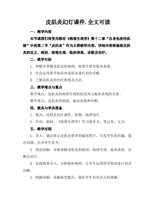 皮肌炎幻灯课件.全文可读