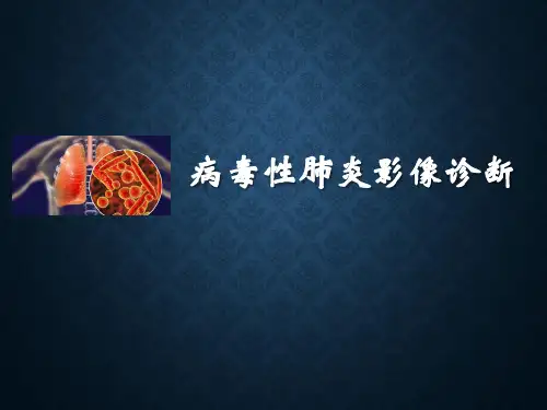 病毒性肺炎影像