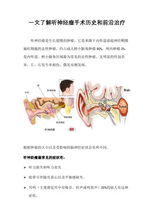 一文了解听神经瘤手术历史和前沿治疗