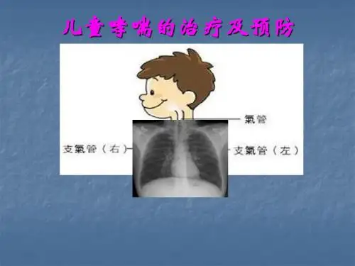儿童哮喘的治疗PPT课件