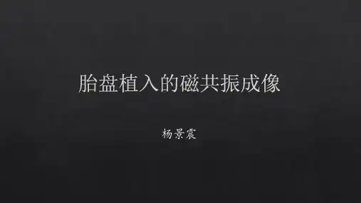 胎盘植入的磁共振表现