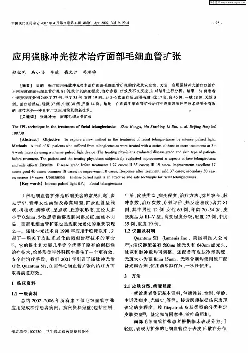 应用强脉冲光技术治疗面部毛细血管扩张