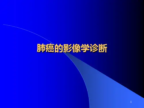 肺癌影像学诊断PPT课件