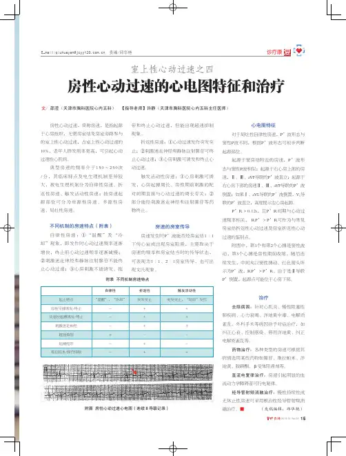 房性心动过速的心电图特征和治疗