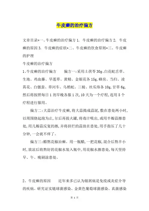 牛皮癣的治疗偏方