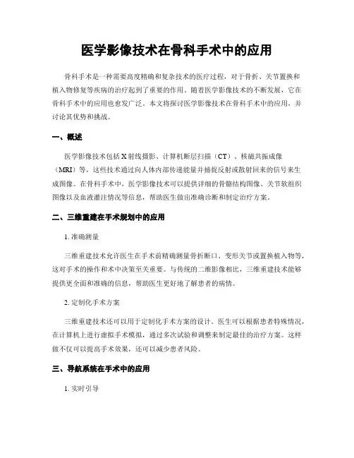医学影像技术在骨科手术中的应用