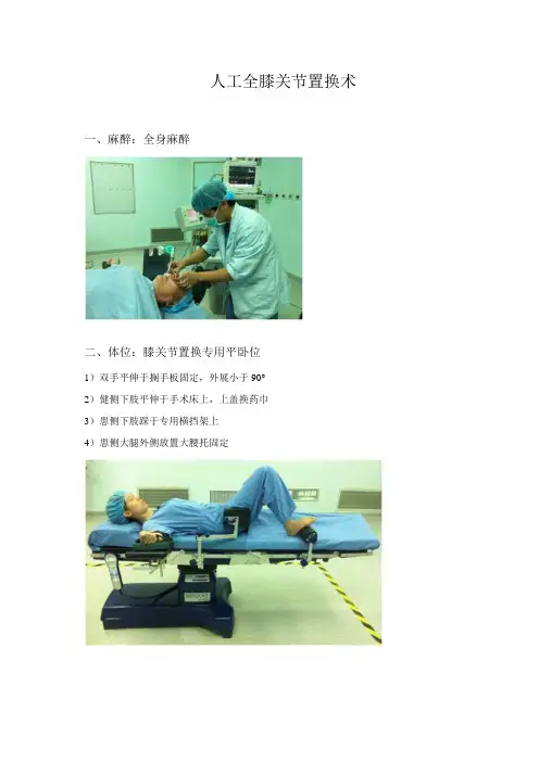 手术室人工全膝关节置换术手术配合(配彩图)
