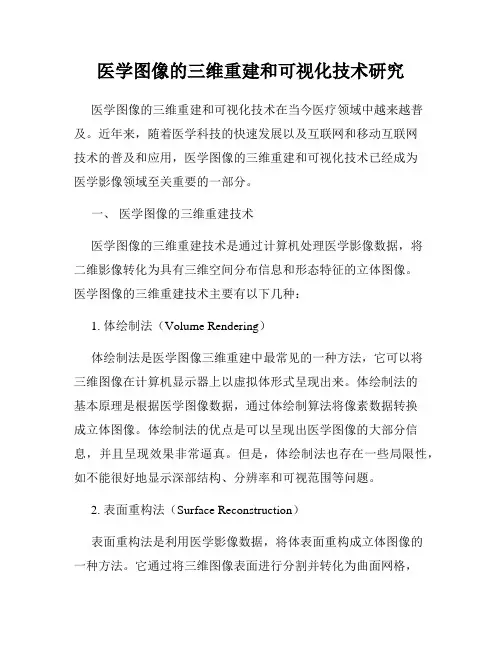 医学图像的三维重建和可视化技术研究