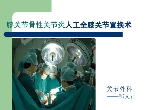 人工全膝关节置换护理查房