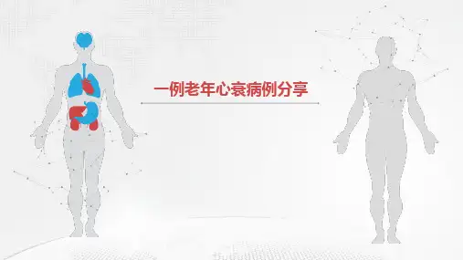 一例老年心衰病例的分享