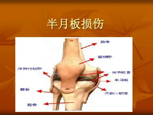 【医学】半月板损伤影像表现