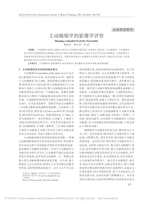 主动脉缩窄的影像学评价