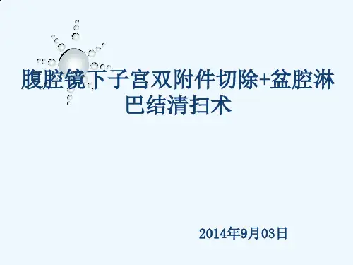 腹腔镜下子宫双附件切除+盆腔淋巴结清扫术