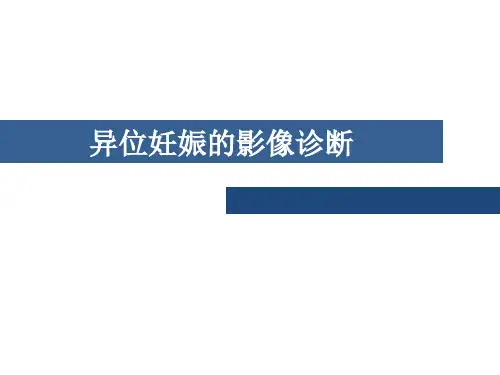 异位妊娠的影像诊断