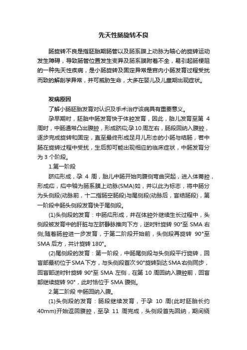 先天性肠旋转不良
