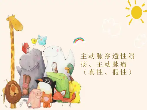 主动脉穿透性溃疡和主动脉瘤的影像表现