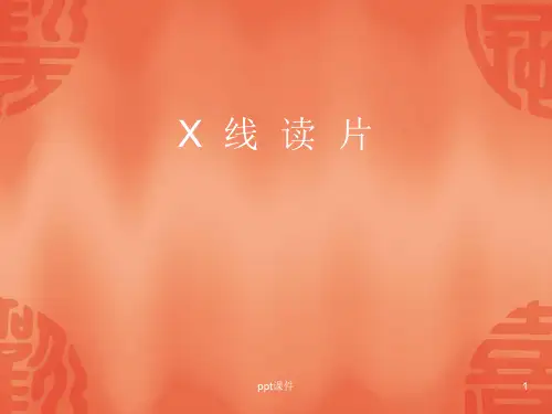 x线读片ppt课件