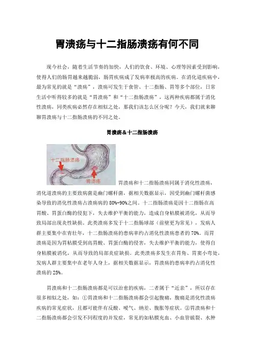 胃溃疡与十二指肠溃疡有何不同