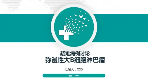 弥漫大B淋巴瘤全