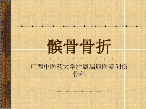 髌骨骨折课件ppt