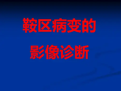 鞍区病变影像诊断-(上)