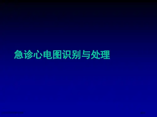 急诊心电图识别与处理