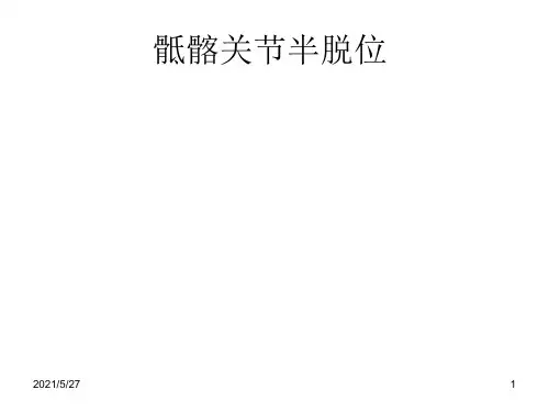 骶髂关节半脱位